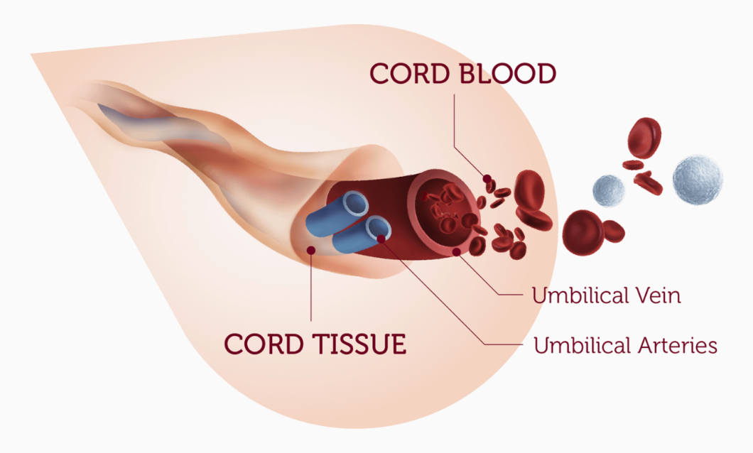Umbilical Cord Blood Banking – Preserving Life’s Potential for Medical Needs